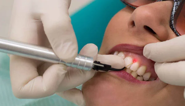 Chirurgie dentară