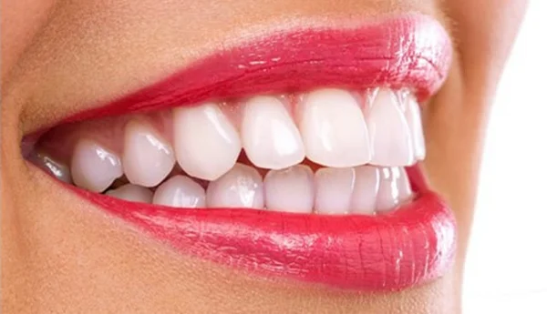Profilaxie dentară